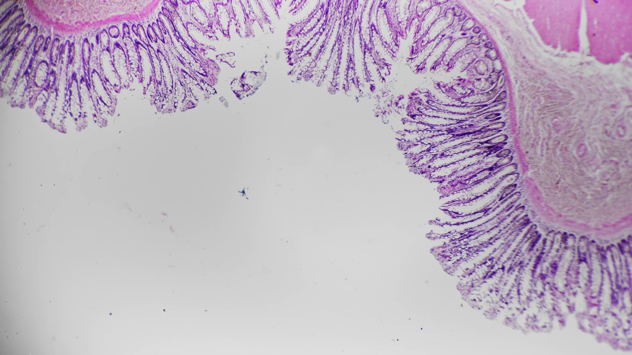 在医院实验室40倍医用显微镜下拍摄的人结肠切片视频素材
