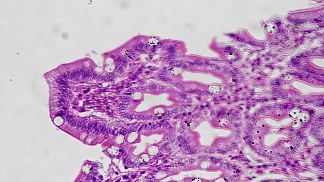 人大肠切片在显微镜下放大400倍视频素材
