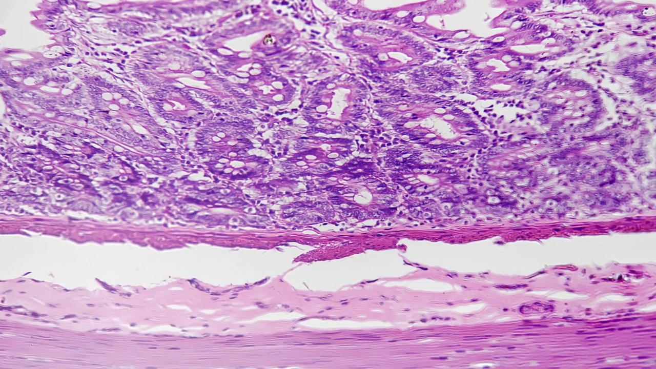 人大肠切片在显微镜下放大200倍视频素材