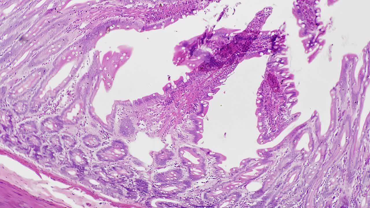人大肠切片在显微镜下放大100倍视频素材