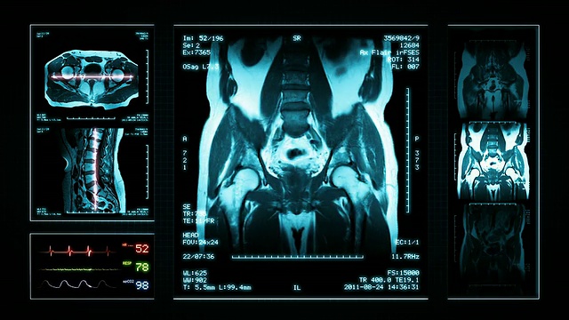 骨盆MRI扫描。顶部，正面和侧面视图。蓝色的。视频素材