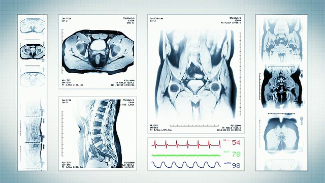 骨盆MRI扫描。顶部，正面和侧面视图。白色视频素材