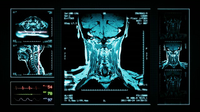 颈部磁共振成像扫描。顶部，正面和侧面视图。蓝色的。视频素材