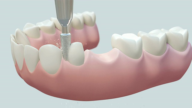 HD:牙桥白视频素材