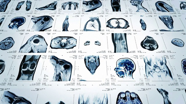 磁共振成像视频墙。黑色和白色。Loopable。正面的看法。视频素材