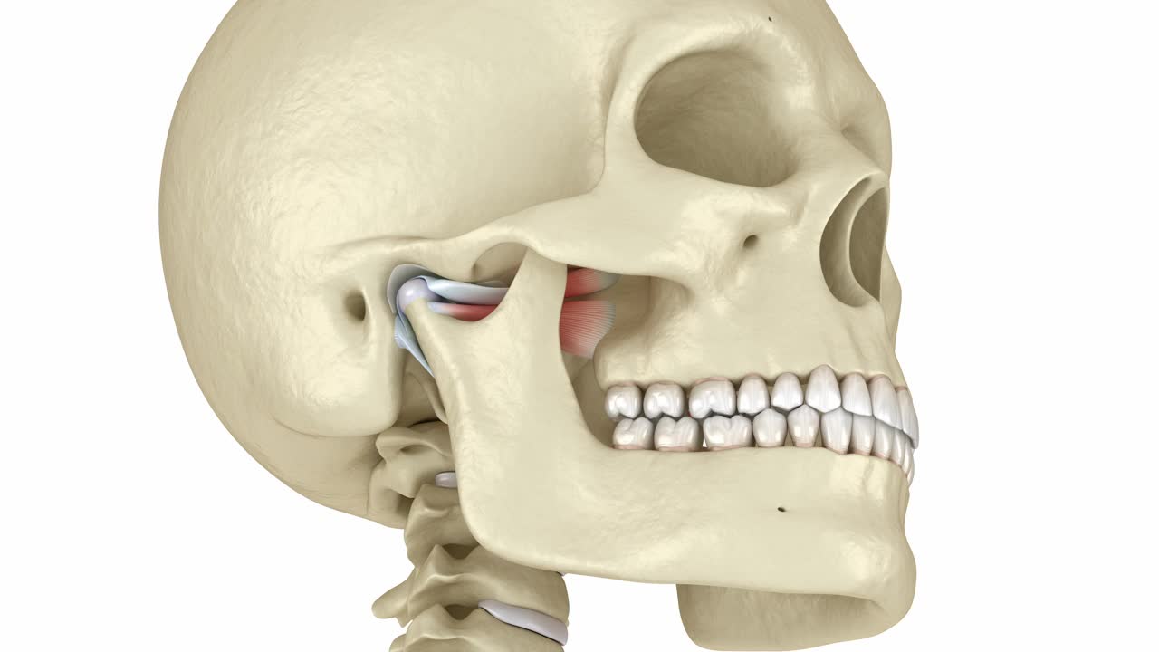 颞下颌关节和关节盘脱位。医学上精确的3D动画视频素材