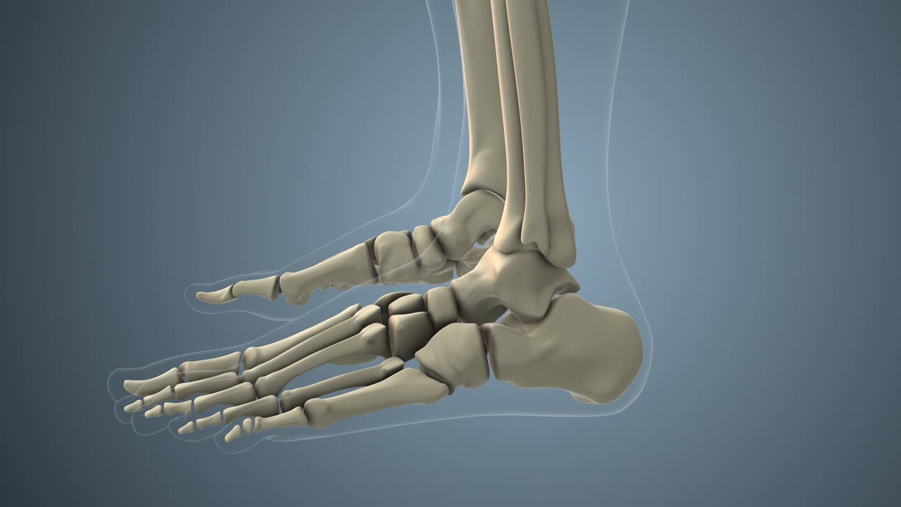 癌症沿跗骨扩散视频素材