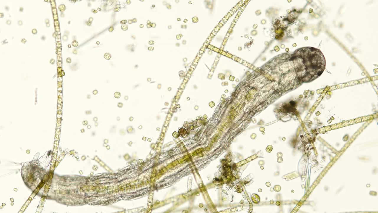 昆虫幼虫(直翅目-双翅目)在光镜下× 100倍放大视频素材