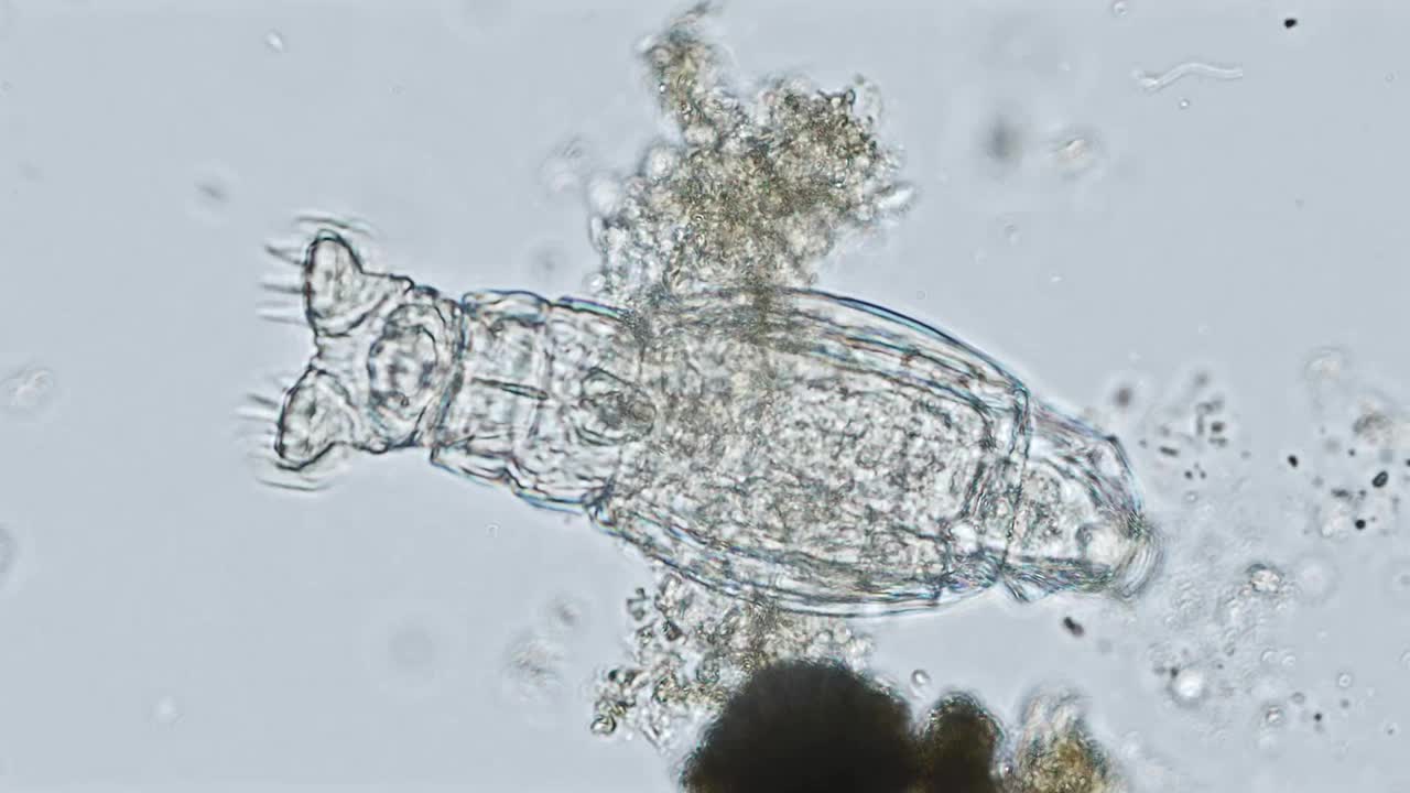 光学显微镜x400倍放大镜下的盘形虫视频素材