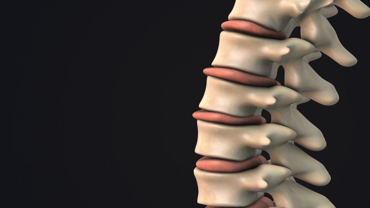 人类脊柱椎间盘突出视频素材