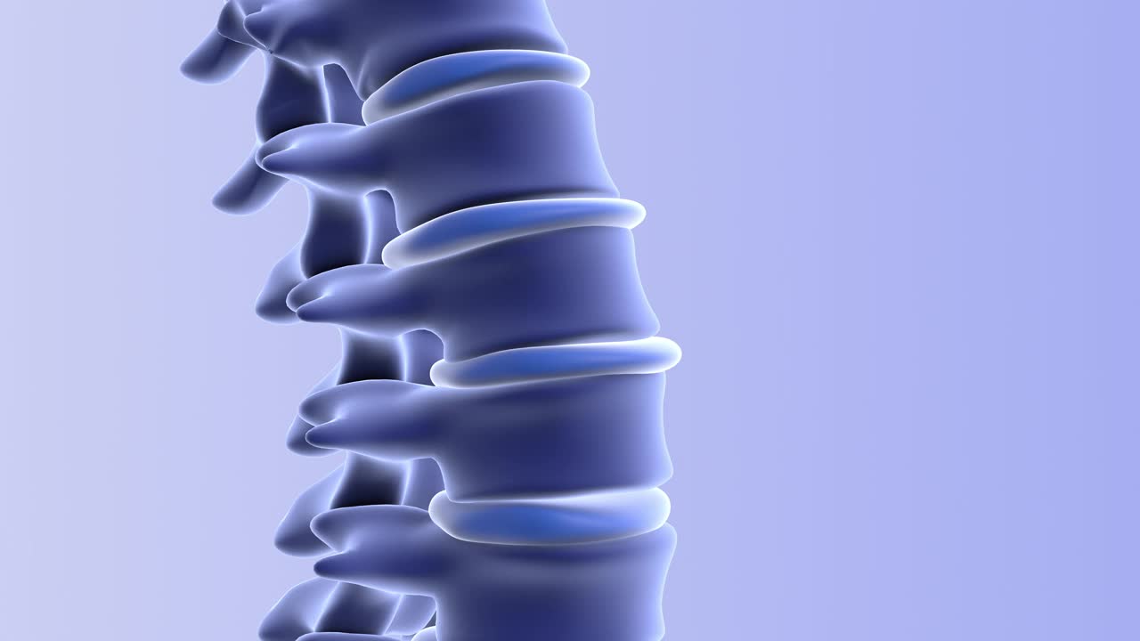 椎间盘突出的人脊柱视频素材