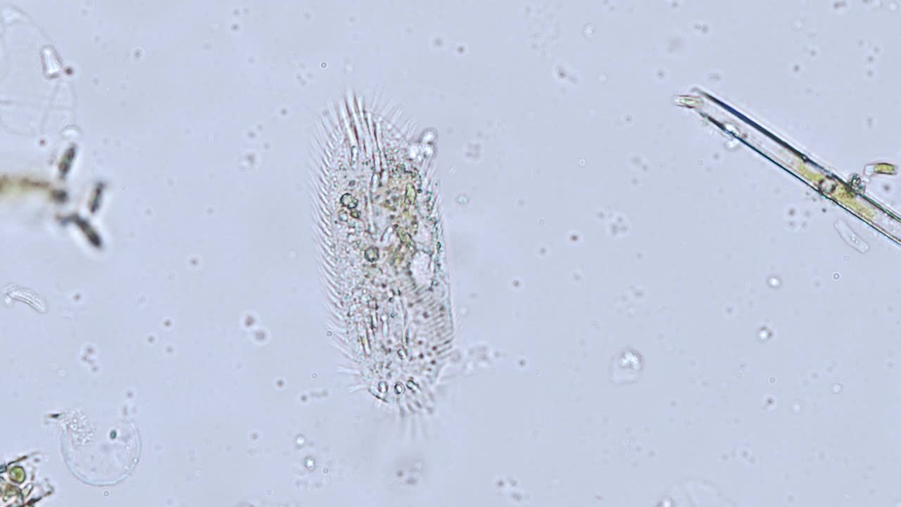 显微镜下的河流纤毛虫(纤毛虫原生动物)-光学显微镜x400放大视频素材