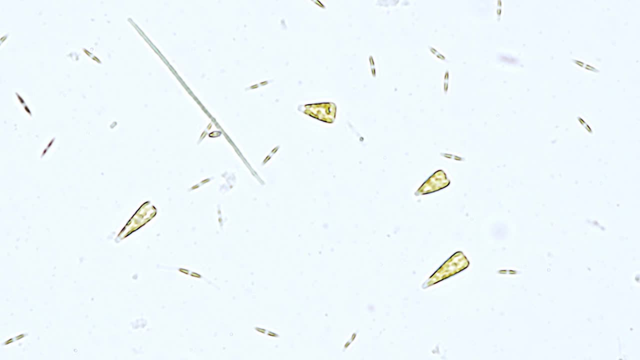 显微镜下的海洋硅藻-光学显微镜x400放大视频下载