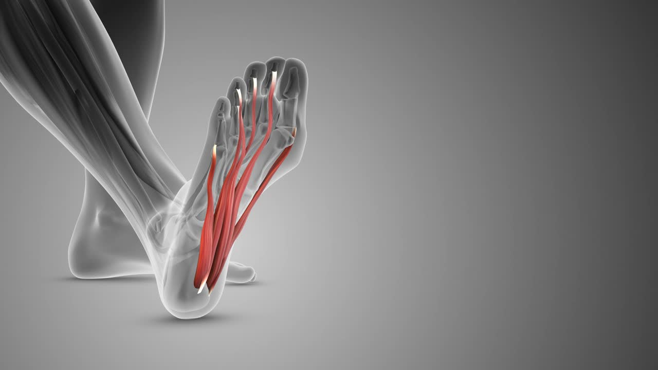 足底筋膜是一条带状组织视频下载