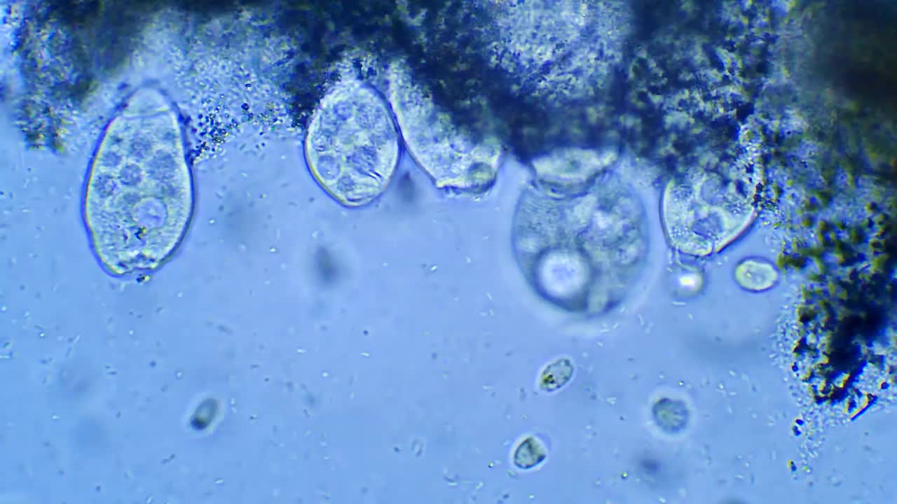 微生物Vorticella，放大40倍视频下载