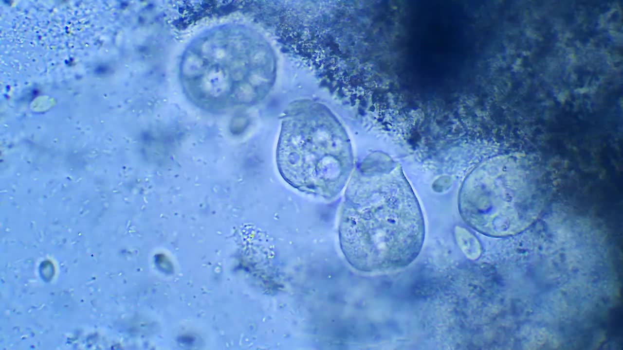 微生物Vorticella，放大40倍视频素材