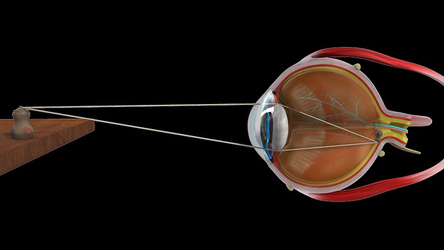 远视正常眼视频素材