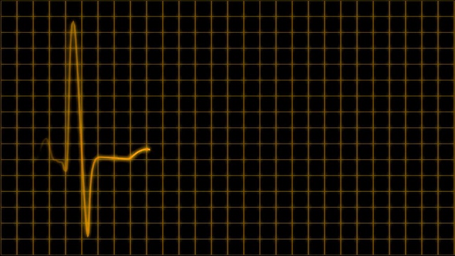 心电图示波器屏幕上有方格橙黄环视频素材