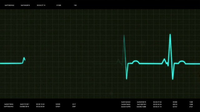 心电图心跳监测器，快视频素材