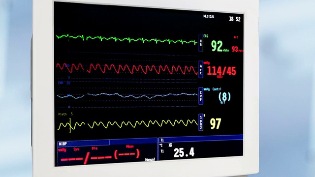 旋转心电图监测视频素材