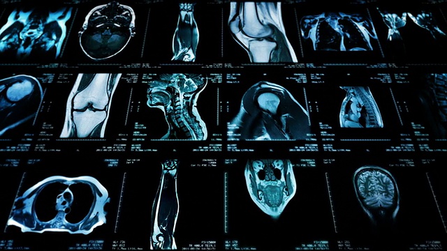 磁共振成像视频墙。黑色和白色。Loopable。横向多莉。视频素材