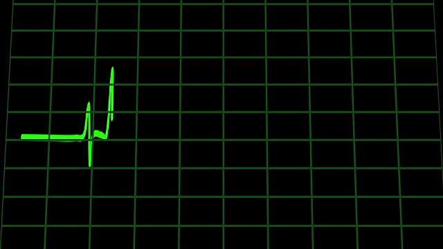 图形，心电图心脏监护仪视频素材