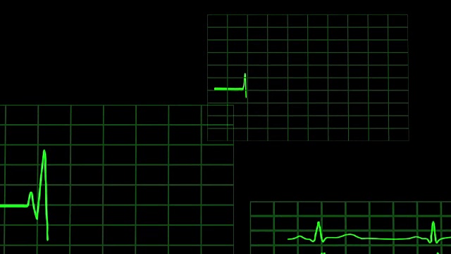 图形，心电图心脏监护仪视频素材