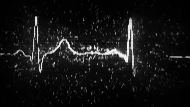 数字心脏监护仪，心电图，心电图，可循环视频素材