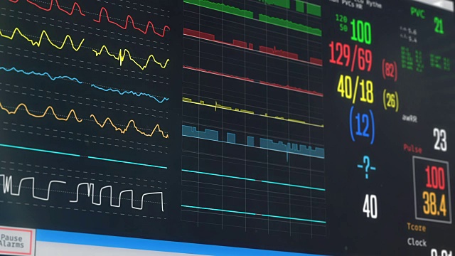 ICU床边监护仪显示患者的生命体征、高烧、病情视频素材