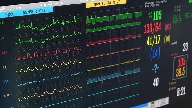 ICU监护仪显示患者病情、高烧、心律失常、病情视频素材