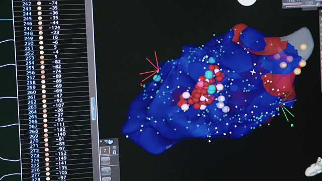 医院心导管术中心脏的医学成像视频素材