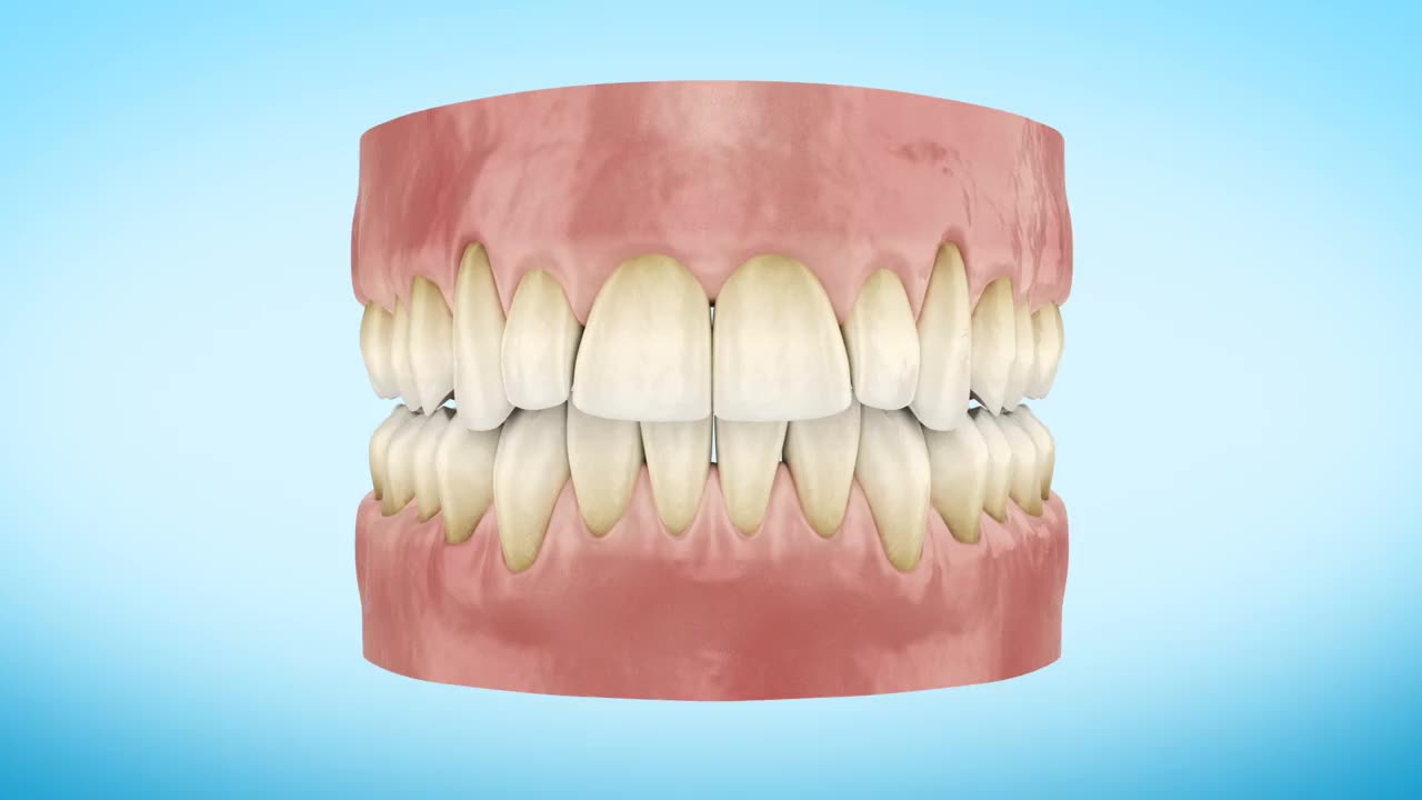 牙齿美白程序近距离3d动画。视频素材