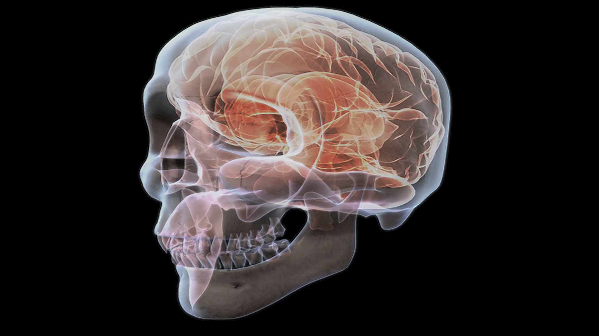 在黑色背景下x光透视下从左到右的头颅和大脑。大脑逐渐淡出，并以橙色来强调它的结构。视频素材