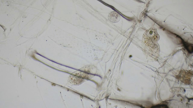 纤毛草履虫在显微镜下为4k视频素材