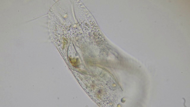 纤毛草履虫在显微镜下为4k视频素材