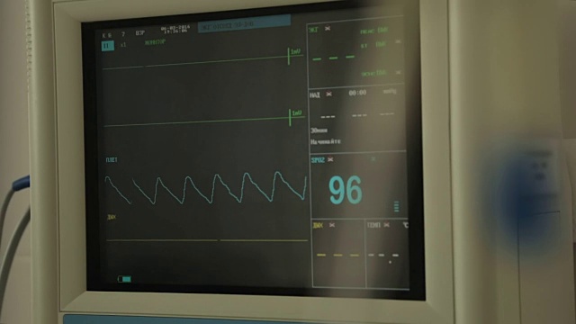 病房壁上心率监测器，生命指标分析，医学视频素材
