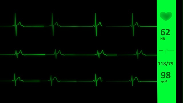 心电图/心电图心线|生命体征视频素材