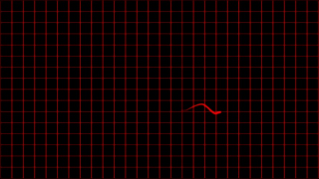 心电图心电图示波器屏幕循环4k视频素材