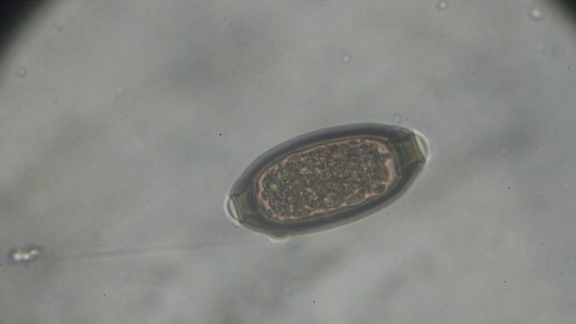 光显微镜下鞭虫卵视频素材