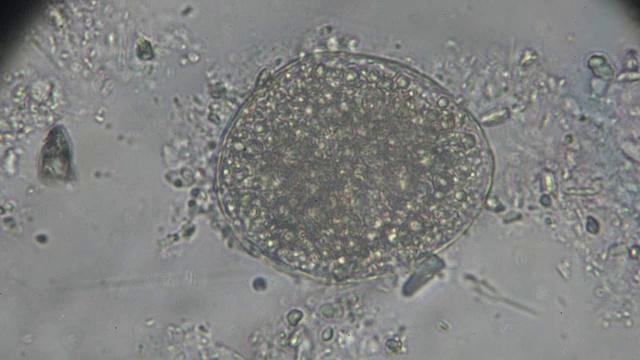日本血吸虫虫卵光镜下观察视频素材
