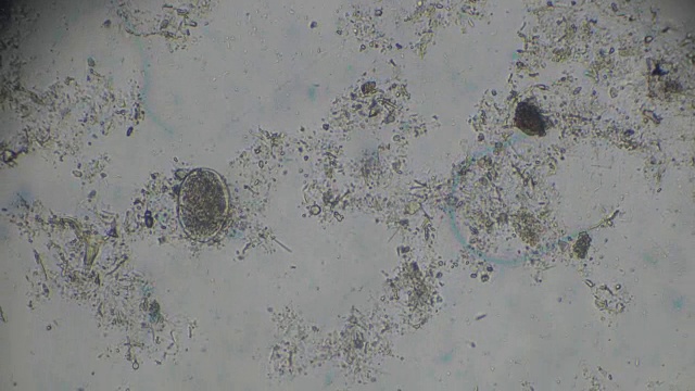 日本血吸虫虫卵光镜下观察视频素材