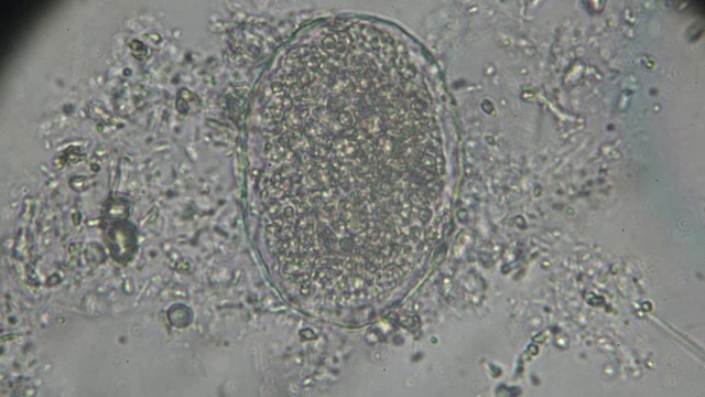 日本血吸虫虫卵光镜下观察视频素材