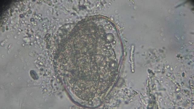 日本血吸虫虫卵光镜下观察视频素材