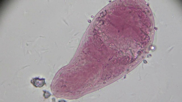 日本血吸虫尾蚴光镜下观察视频素材