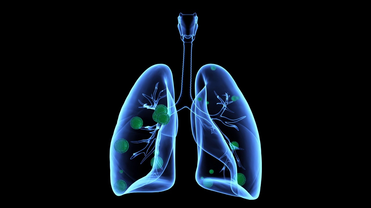 3D模拟人体肺部绿色病毒侵入感染视频下载