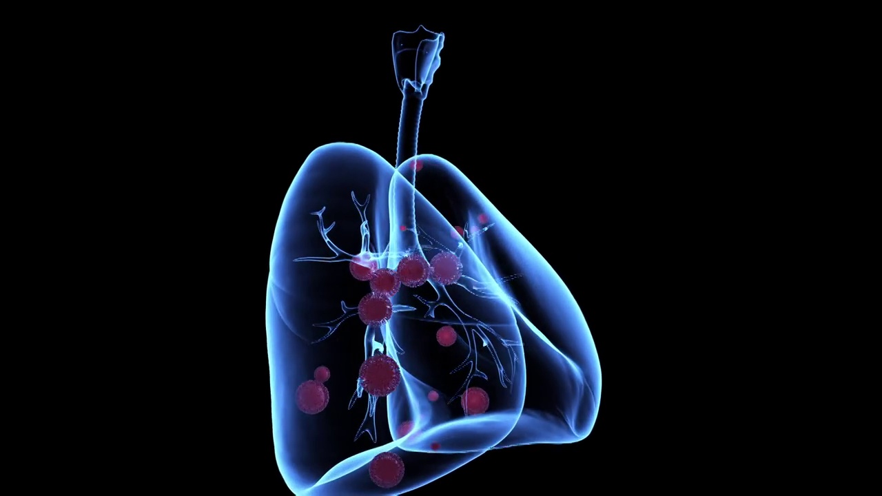 3D模拟人体肺部红色新冠病毒侵入感染视频下载