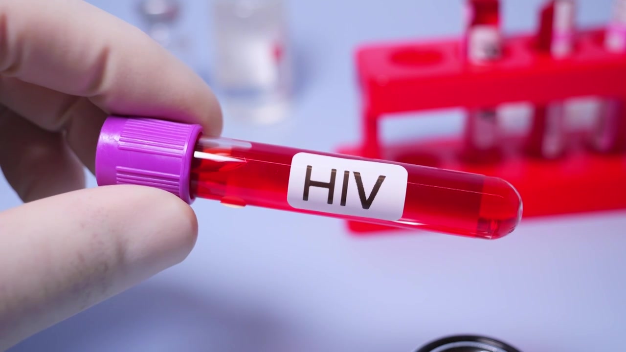 HIV艾滋病，又称获得性免疫缺陷综合征（AIDS）,医疗健康主题视频下载