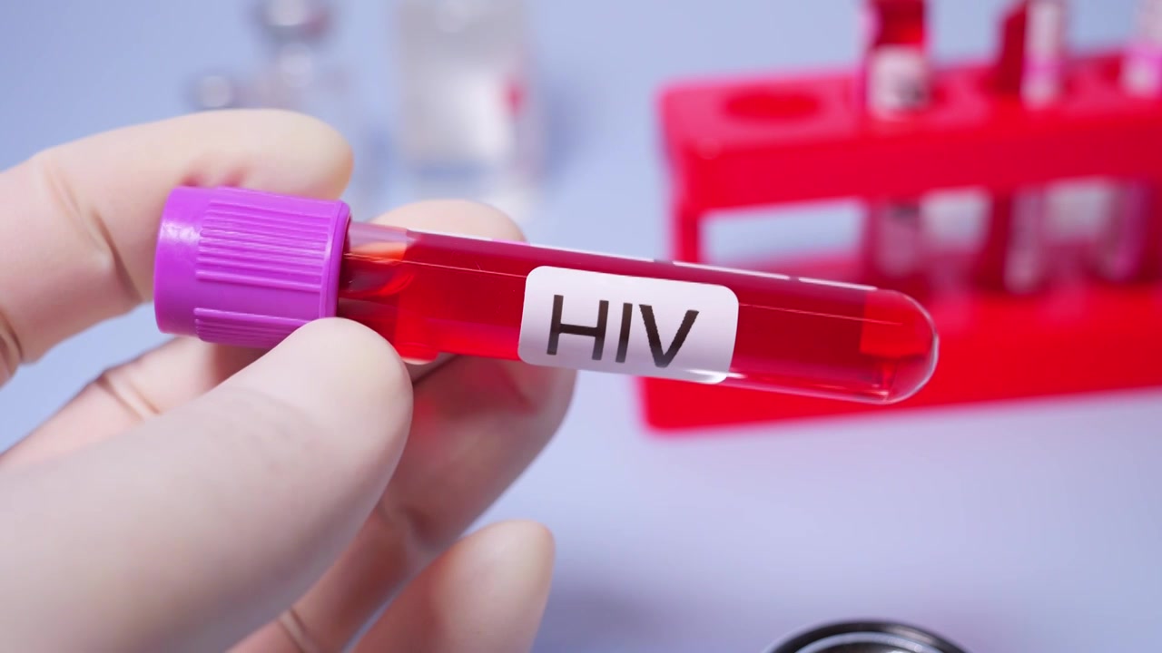 HIV艾滋病，又称获得性免疫缺陷综合征（AIDS）,医疗健康主题视频下载