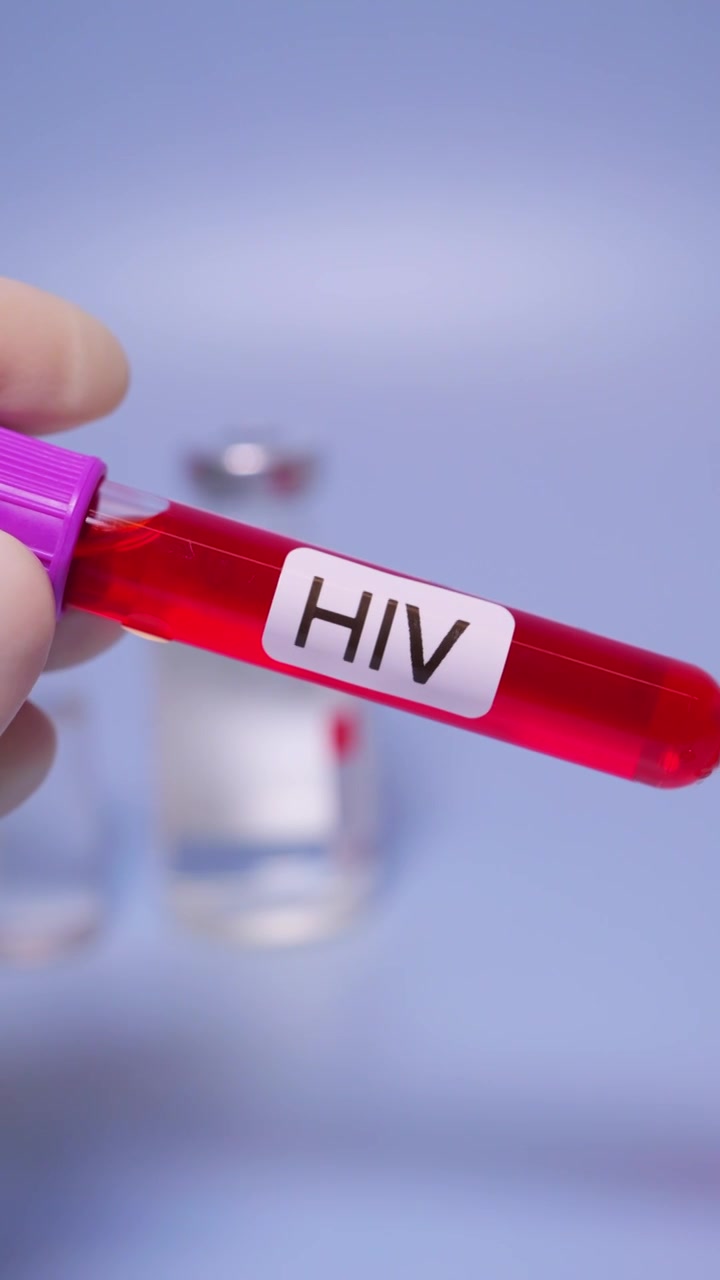 HIV艾滋病，又称获得性免疫缺陷综合征（AIDS）,医疗健康主题视频下载