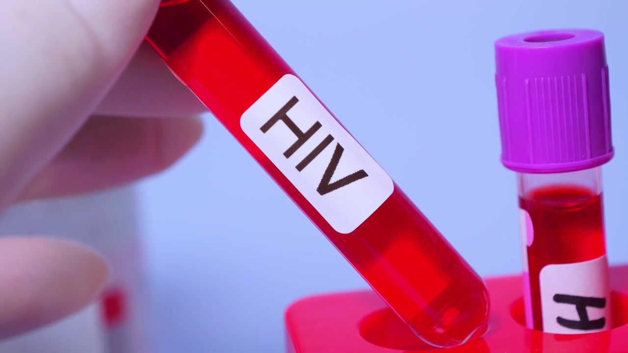 HIV艾滋病，又称获得性免疫缺陷综合征（AIDS）,医疗健康主题视频下载